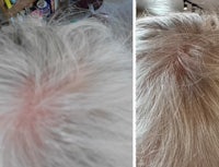 a woman's hair before and after a hair transplant