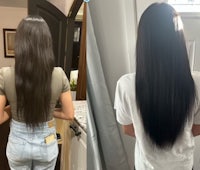 a woman with long hair before and after a hair transplant